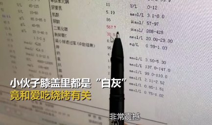 膝盖|一顿饭后，小伙膝盖肿成“面包”！医生瞬间看懵：这种习惯赶紧戒