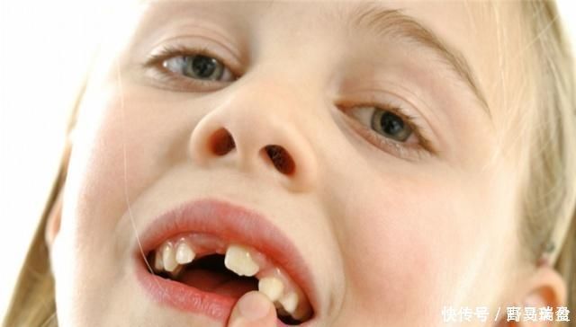 生长发育|语心聊育儿随着年龄的增长宝宝牙齿的健康，父母应该注意
