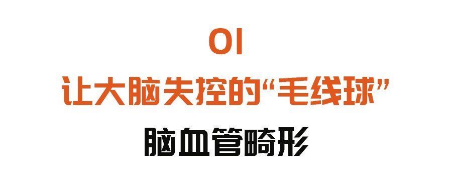 毛细血管|这五个症状，是脑血管“崩溃”的前兆！没有三高的人，也要当心