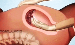 胎盘|生孩子后胎盘是怎样下来的, 看过这组动图你就明白了!