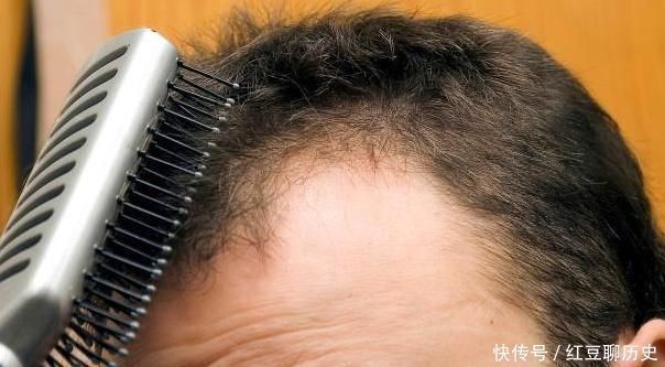 眼袋|男人衰老时，会出现4个异常，若一个没有，你会比同龄人更显年轻