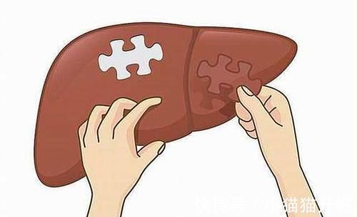 扁鹊内经|肝若硬化，头先知？头部若出现5个异常，建议：去医院做肝CT检查