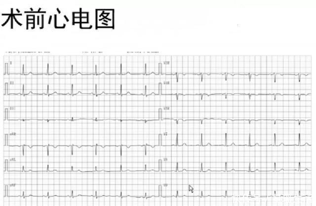 西地兰静推速度