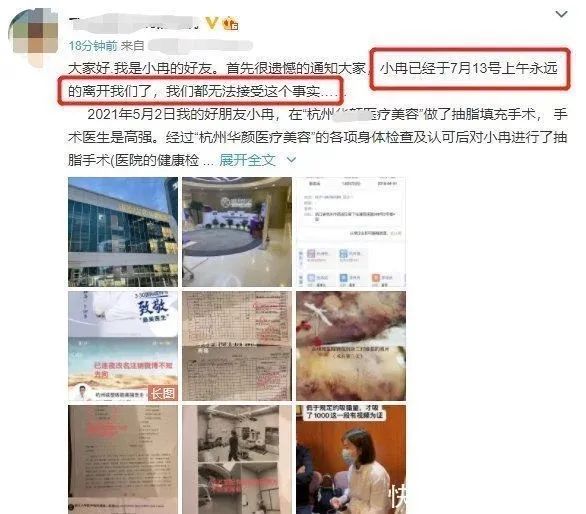 脂肪|别轻易尝试！“网红”抽脂感染去世，医生提醒→