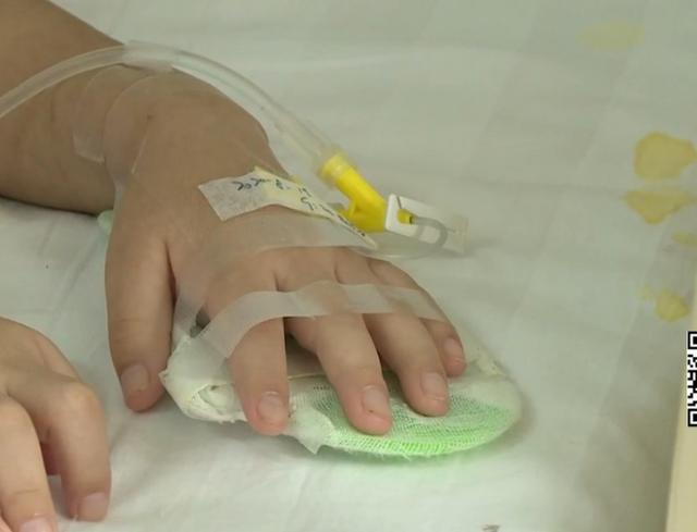 血管瘤|4岁女童头上的胎记,一查竟是血管瘤,医生给出了答案