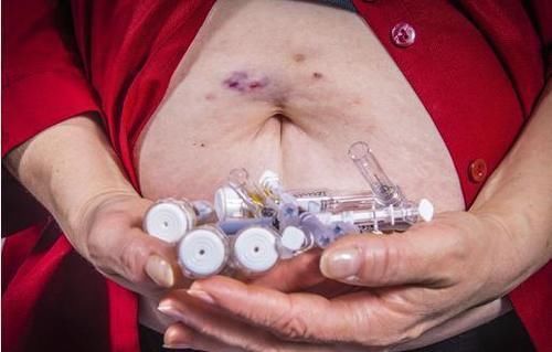 暂时性|身体出现这4个异常,或是糖尿病正在恶化,需警惕并发症!