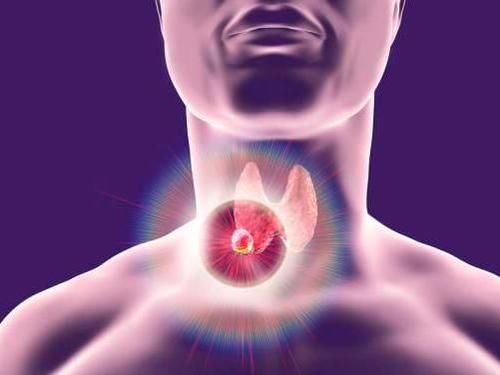 结节|结节、息肉、囊肿、增生，哪个是癌症“先兆”？一文给你说清