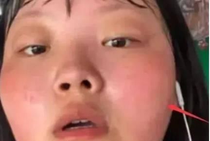 女生洗脸时的“3禁忌”，难怪脸越洗越丑，尤其第2易长螨虫哦