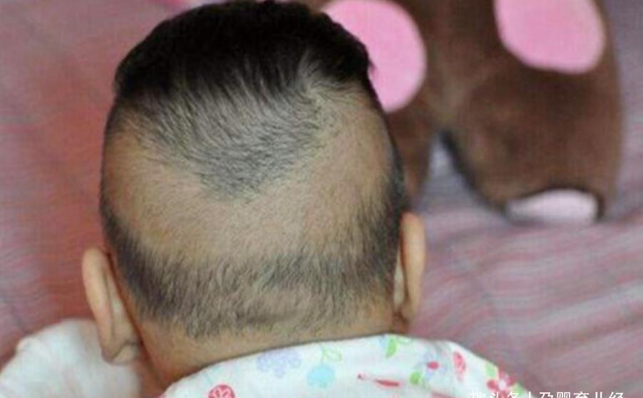 光头|夏日炎炎,给宝宝剃光头能降温吗?剃光头的3个危害了解一下