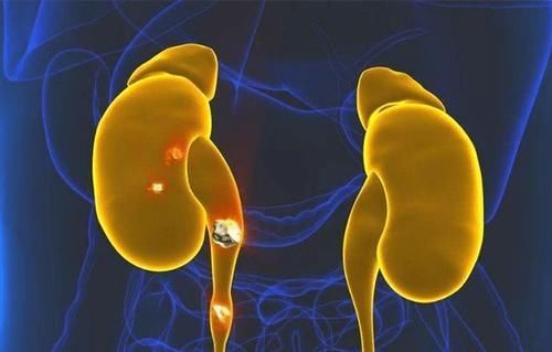 腰部|肾好的人，3个部位容易“发热”，若你全中，恭喜，肾脏还很健康