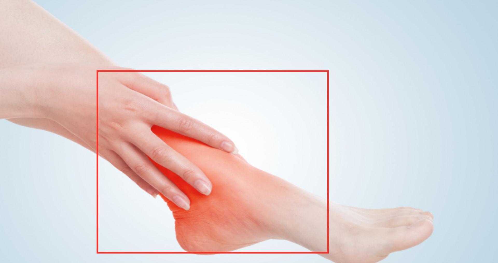 运动量|假如我们脚后跟痛,千万不要忍,可能与疾病相关