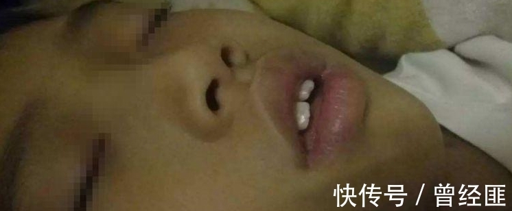 老公|孩子越长越像猴子，老公怀疑老婆整容了，检查结果全家人都吓坏了