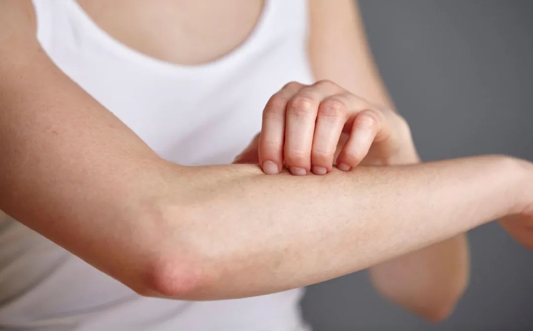 秋冬|皮肤瘙痒,秋冬加剧者,这个良方或能缓解,可从根源上解决难题