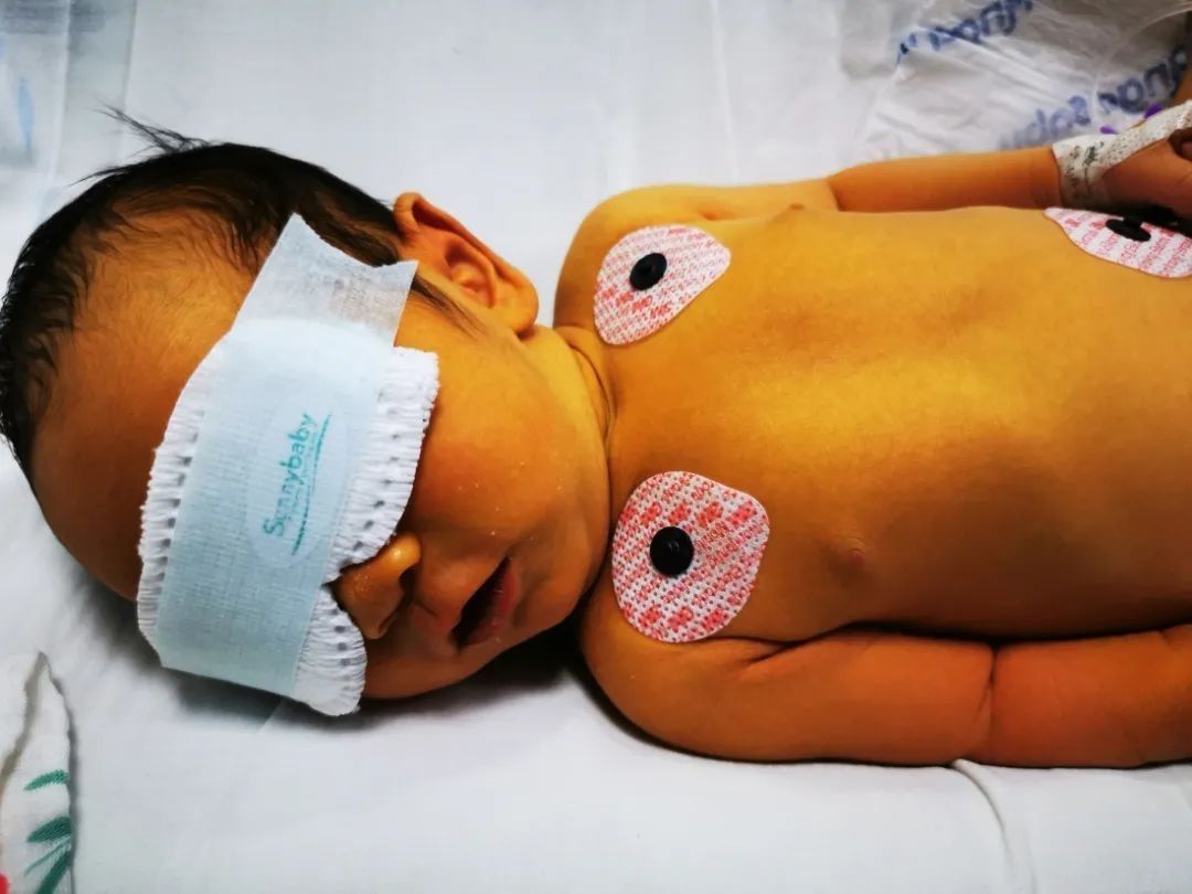 饮食习惯|孕妈要管住嘴,3种食物尽量少吃,宝宝出生后就算有黄疸也不严重