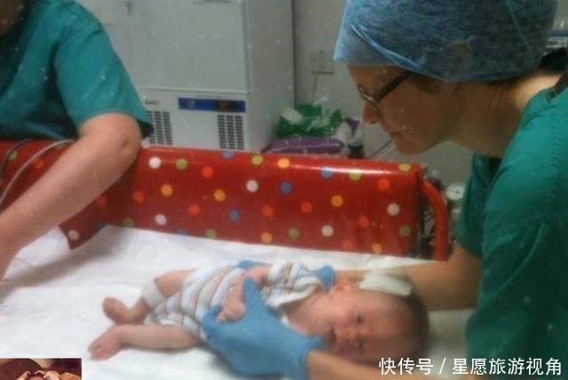 医生们|生下“无脑”宝宝吓坏众人,夫妻细心照顾三年,如今现状堪称奇迹