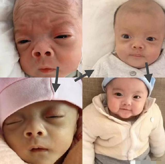 新生|宝宝出生宛若“外星人”丑哭宝妈,如今长开了变化很大,妈妈笑了