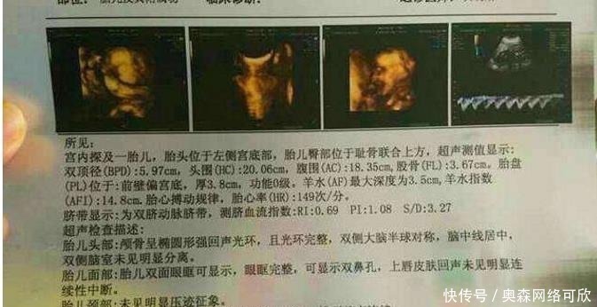 宝宝|准妈若怀有小阿哥,做B超时会有哪些数据?不妨验证一下吧