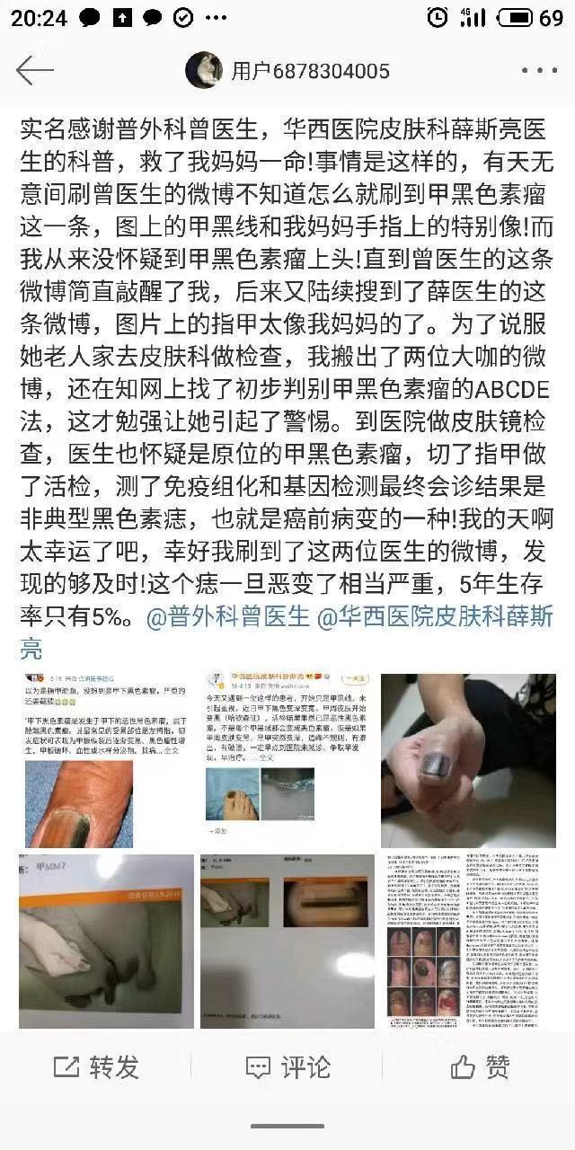 医生|指甲上有黑线,可能是最恶的癌症,医生教你怎么办