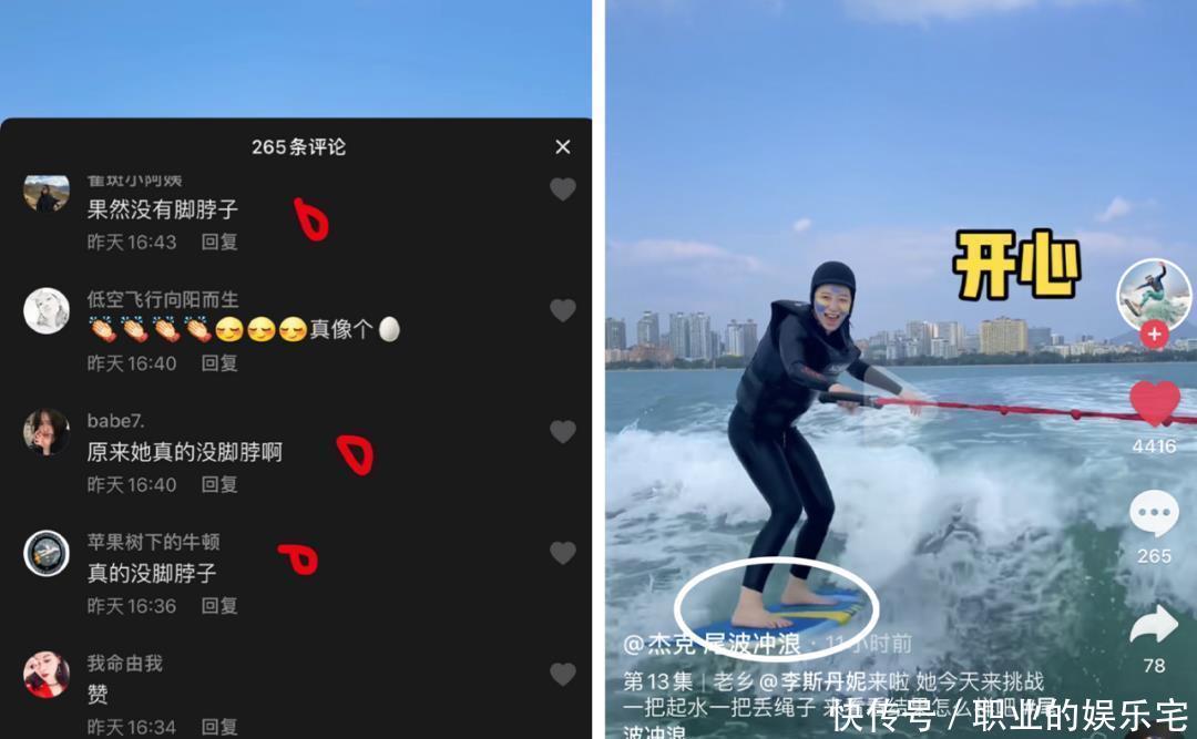 细带|是时候穿凉鞋了！今年流行这几款，清凉显脚小