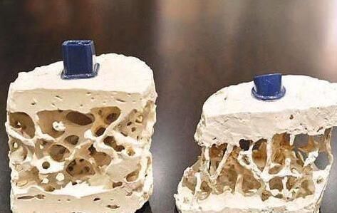 猪骨|最好的补钙食物,是牛奶、虾皮还是骨头汤?天天补钙,你未必吃对