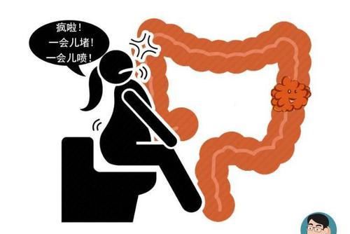  肠癌|为何年纪轻轻会患上肠癌？若有这6个异常，要及时做肠镜检查