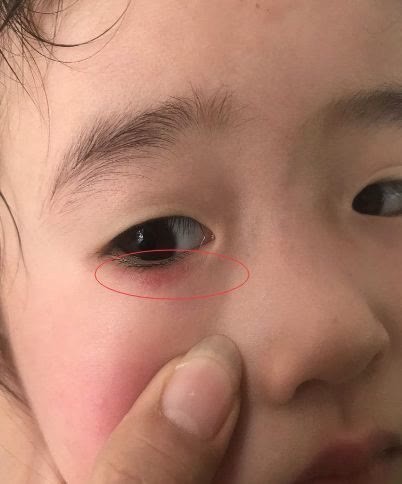 男孩|14岁男孩身高已有183cm,儿科医生:4种食物是入秋“长高王”