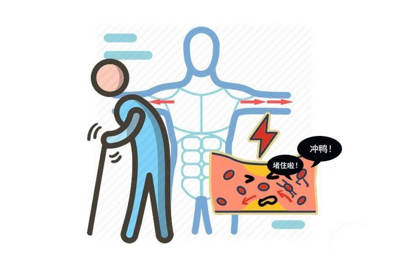 胆囊结石|一天吃4个鸡蛋,胆囊长满结石?鸡蛋吃多了,会导致胆固醇高吗?