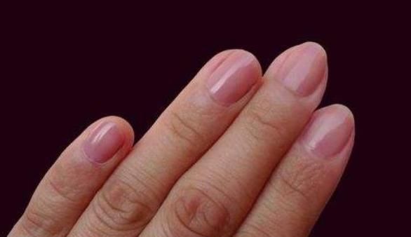 慢性炎症性皮肤病|身体生病,指甲先知?指甲若有5种表现,或许是疾病的“信号”!