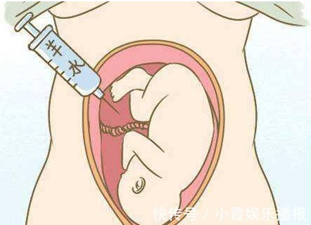 缺水|怀孕期间,孕妈缺水身体会发出三个信号,要及时补水