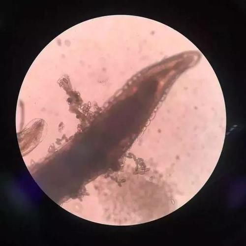 张女士|3岁宝宝晚上哭闹说“屁屁痒”,妈妈脱下裤子一看,有东西在动