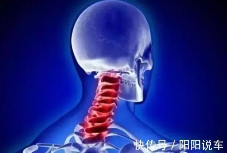 艾灸|40脖子50瘫，60难过鬼门关！中医2招，快速缓解颈椎痛，永不复发
