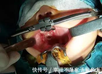 毒物|小小一枚,孩子喉管被腐蚀!再说一遍,这些东西必须放好了