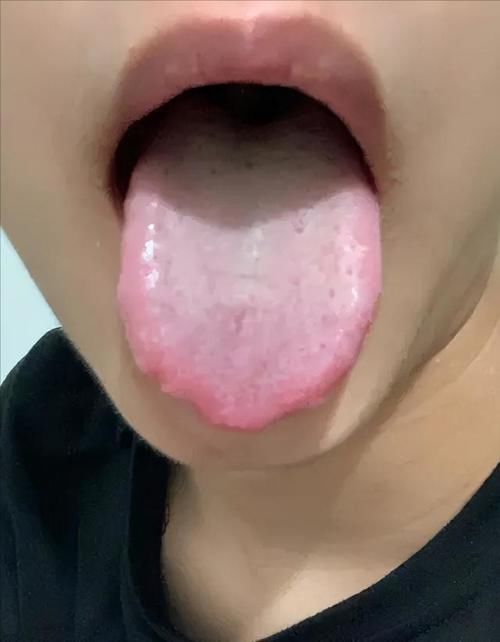 涌泉穴|肾好不好,这三种原因要知道!补肾不盲目,一定要知道3种情况