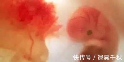 皱缩状|一组图记录怀胎十月，胎儿发育全过程，看完后，感叹生命神奇