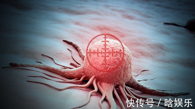 癌症复发|想要治愈癌症,首先要满足4个条件,可惜挺过去的人不多