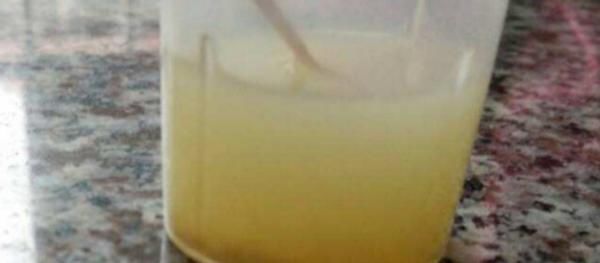 养花会用到这3种药,所以过期了也别丢弃