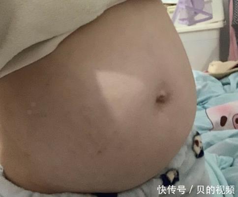 胎儿|孕中期产检被这诊断停育,医生怒斥不想要就别生