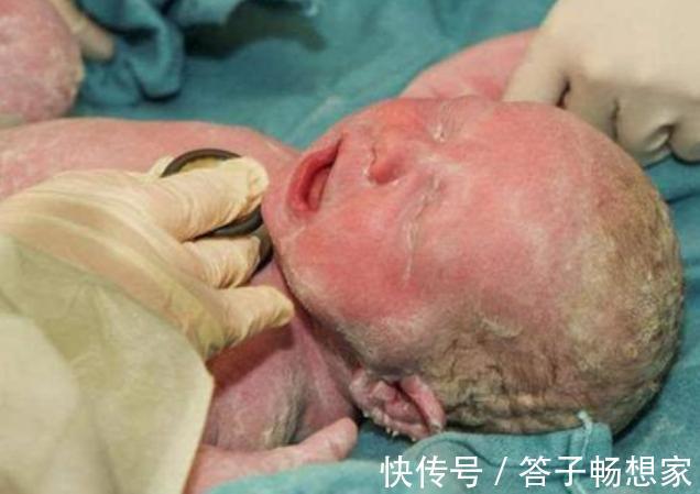 怀胎|怀胎11个月产下“牛奶宝宝”，全家紧张万分，护士恭喜宝妈