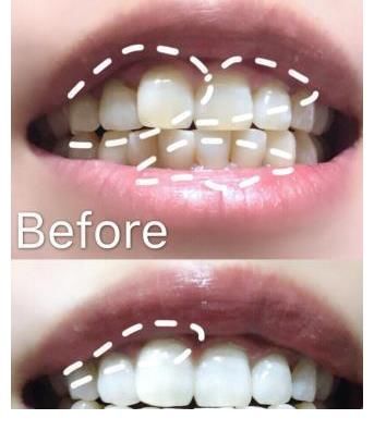 国宝级|被称为“国宝级”的牙膏，却因价格太低无人问津，景甜：用了半管黄渍就没了