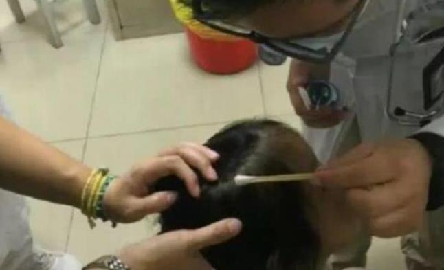 医院|梳头发现''小米粒''，宝爸急忙带女儿去医院，医生：还好来得及时