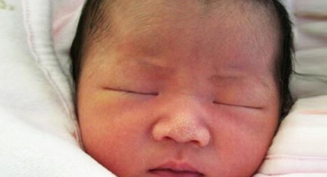 刚出生宝宝鼻子上就长脂肪粒小白点到底是什么