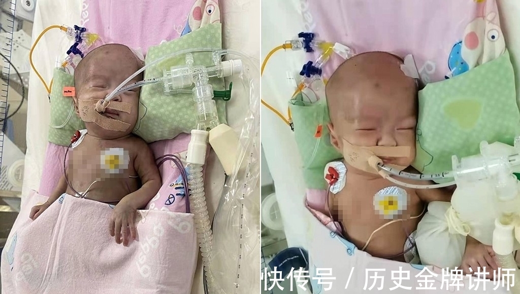 孩子|河南90后女子怀上三胞胎全家人高兴不已,孩子出生后却笑不出来了