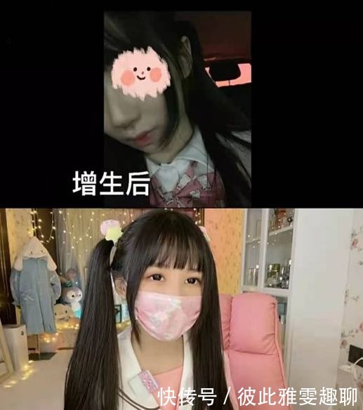 修复|网红蔡萝莉鼻子修复后，大方晒全脸照，五官精致让人心动