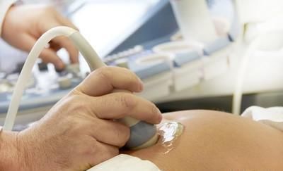 鼻骨|孕23周＋2四维显示无鼻骨，做唐筛NT低风险，孩子能留吗？