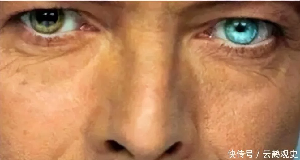 <p>但其实形成这种状况大概有两个原因，第一个原因是家族遗传，如果家中有人异瞳，那他们的后代也很有可能是异瞳。</p>